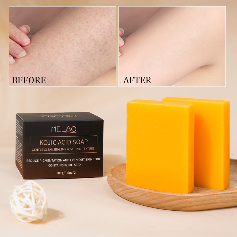 Органическое мыло против акне (Anti-Acne)