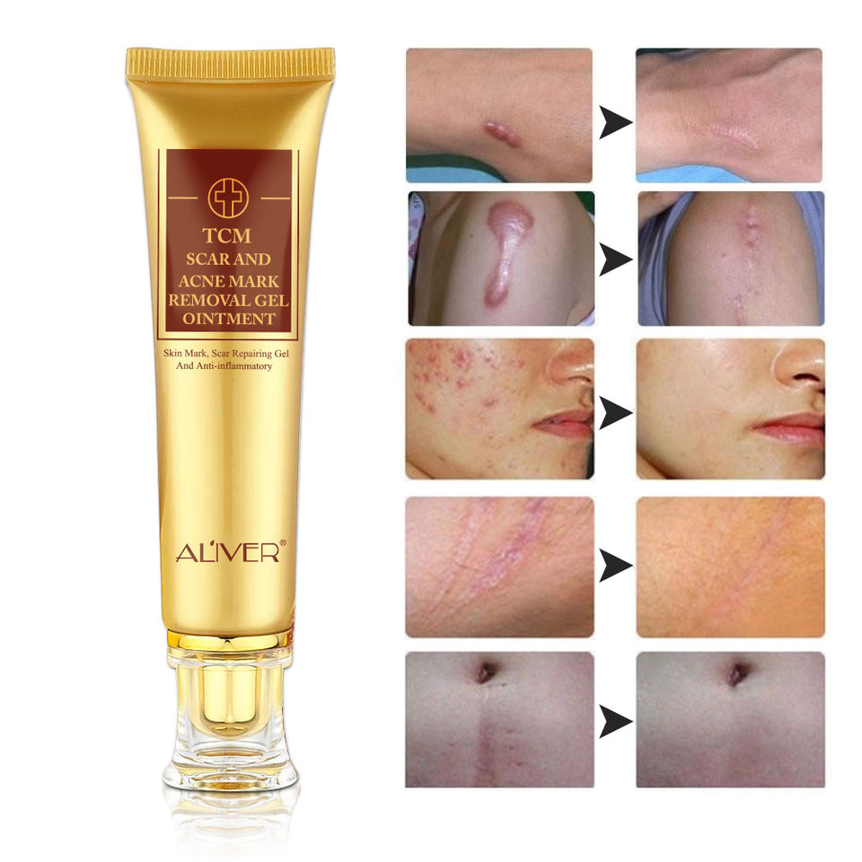 Крем ALIVER Advance Tcm для удаления шрамов