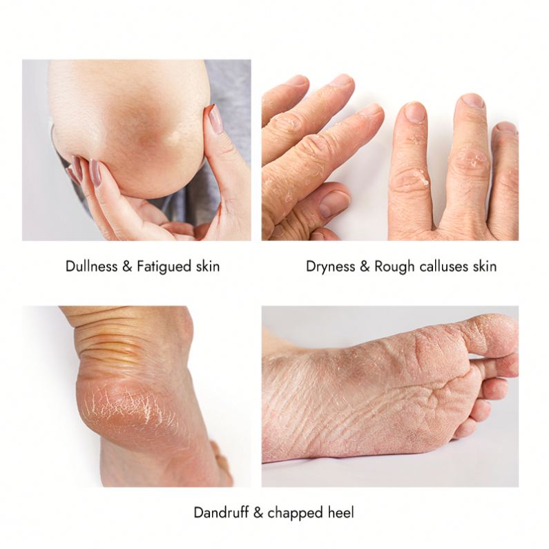 Waxkiss 200g Fully Refined Paraffin Wax Wholesale Paraffin Wax Spa Feet Hands Moisturizing Hard Bath Fir Skin Care