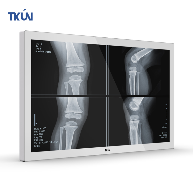 New TKUN 24-Inch Medical Industrial Grade Flat Panel LCD Monitor 1000 Nits SDI DVI 2MP Interface IPS White HD DP