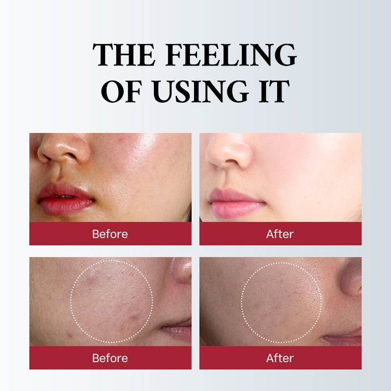 Отбеливающее средство с глутатионом (Skin Whitening)