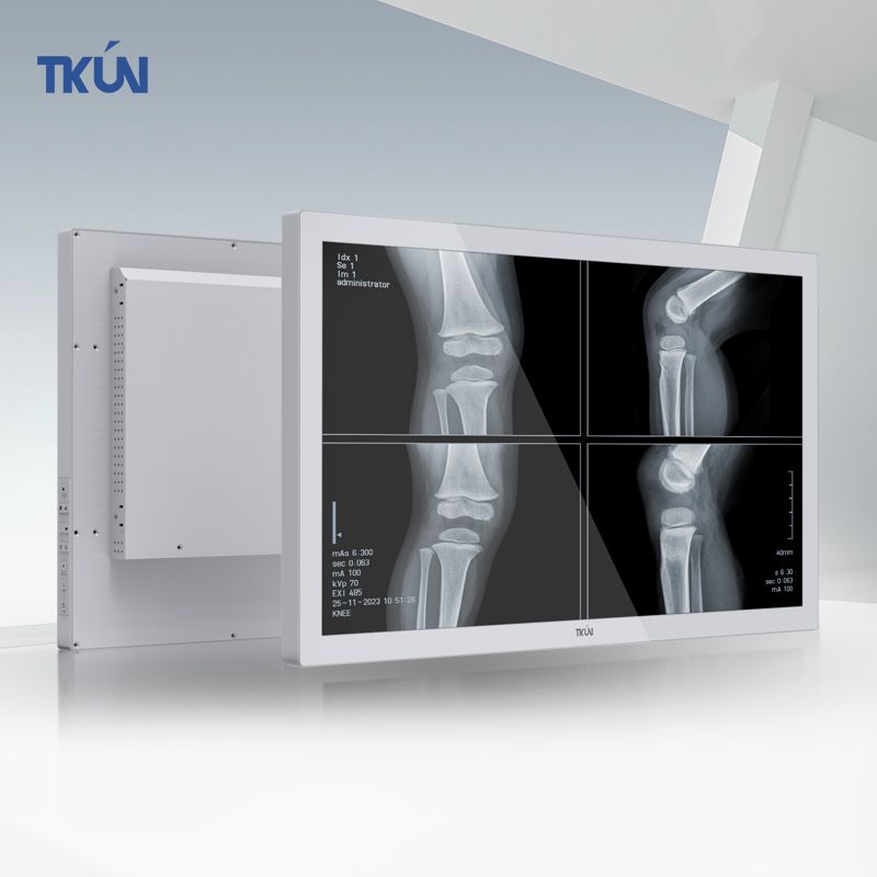 New TKUN 24-Inch Medical Industrial Grade Flat Panel LCD Monitor 1000 Nits SDI DVI 2MP Interface IPS White HD DP