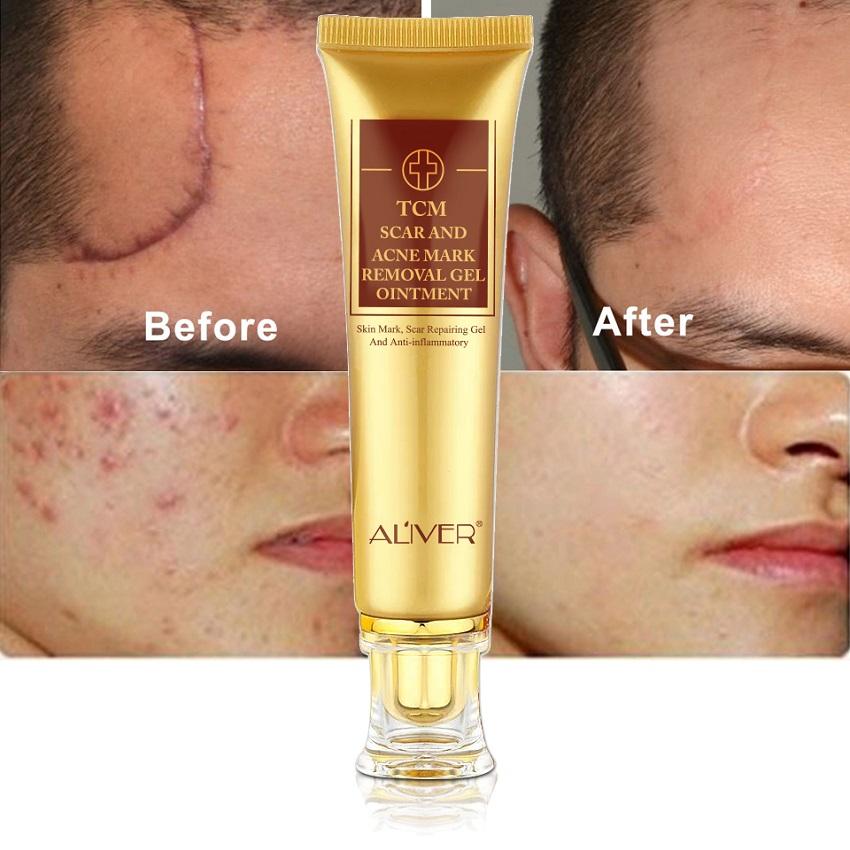 Крем ALIVER Advance Tcm для удаления шрамов